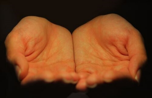 Ból nie musi być twoim wrogiem