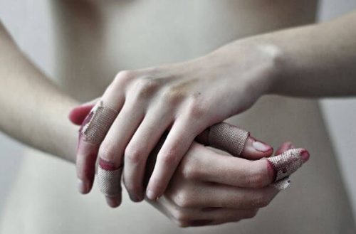 Zranione dłonie - odpowiadasz za swoje życie