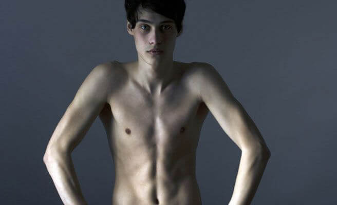 Nastolatek z anoreksją