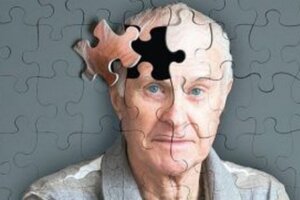 Objawy Alzheimera: 5 znaków ostrzegawczych