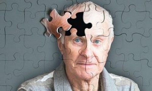 Objawy Alzheimera