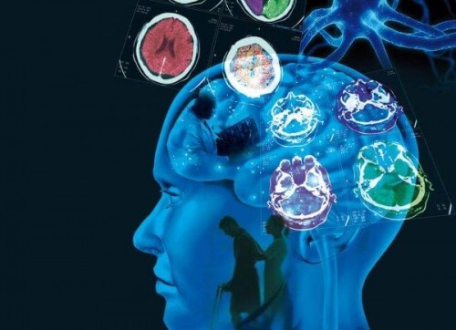 Stwardnienie rozsiane: przyczyny, objawy i leczenie