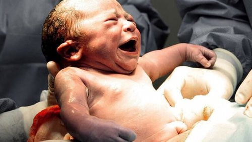 niemowlę i trauma narodzin
