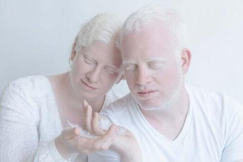 Para albinosów
