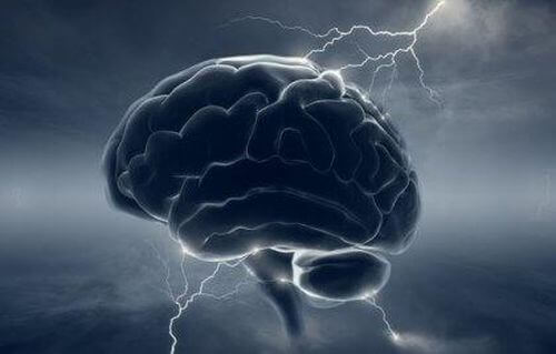 Mózg - migreny i dopamina