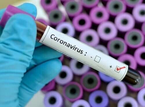 Badanie na koronawirusa