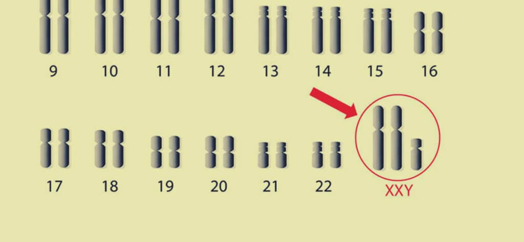 Chromosomy