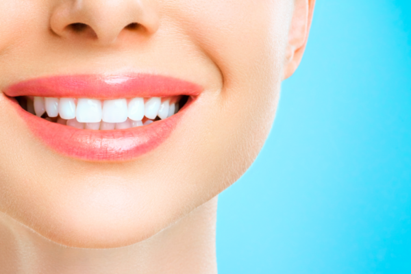 Bleachoreksja: niebezpieczna obsesja na punkcie białych zębów